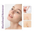 Инструменты косметические для удаления угрей MODAY Blackhead Remover 8 устройств